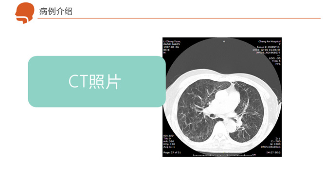 呼吸衰竭护理治疗病例PPT模板